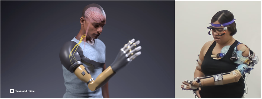 IMC月报 | 医疗机器人行业趋势速递202109